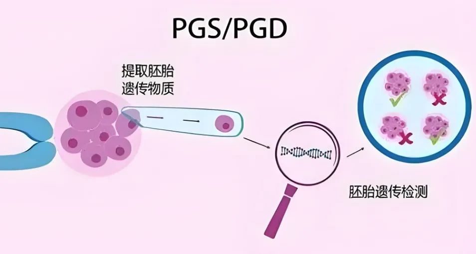 吉尔吉斯斯坦试管助孕套路：低价，高成功率，中介鱼龙混杂…该如何避坑？
